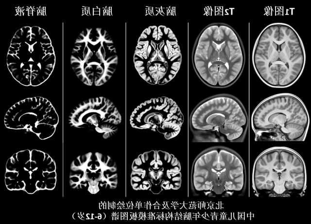 6澳门新葡京博彩及合作单位绘制的中国儿童青少年脑结构标准模板图谱.png